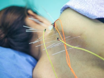 agopuntura e dolore cronico